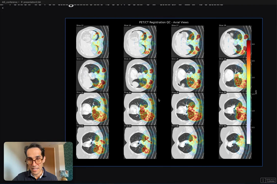 A four-by-four grid of grayscale axial scans with colored overlays and a vertical color scale.