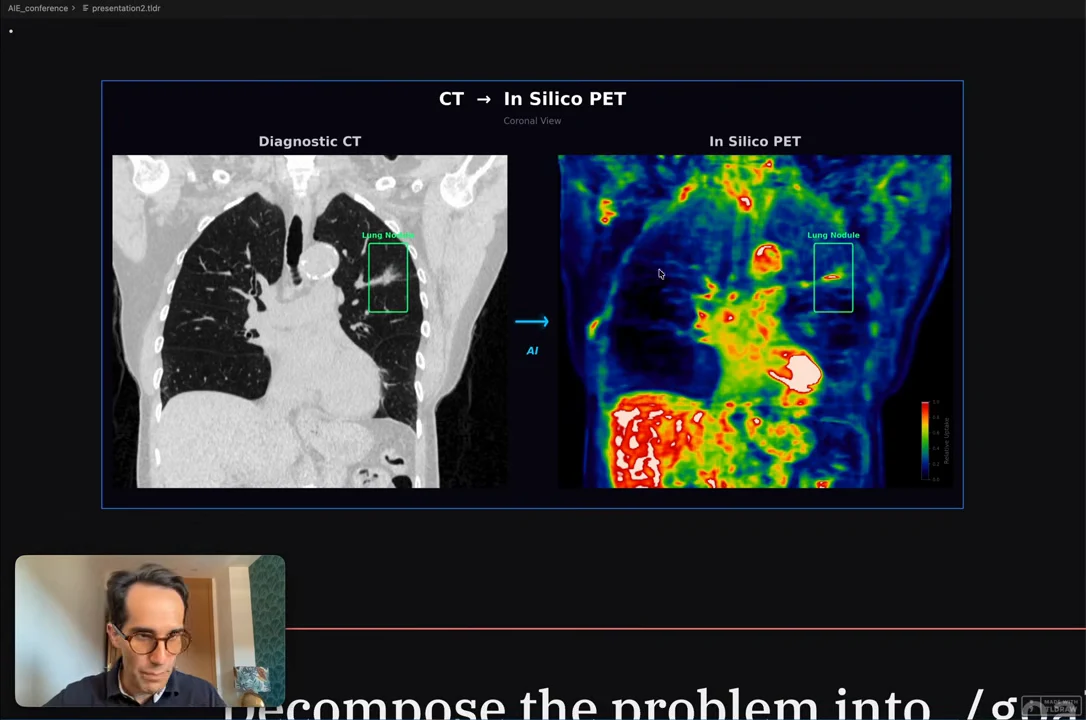 Grayscale chest CT beside a colored in silico PET image, connected by an AI arrow, with green lung-nodule boxes.